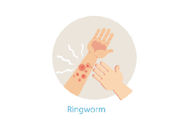 FSC Issues Second Ringworm Advisory